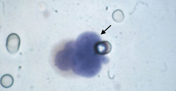 Гост МФ: др Андреја Јовић, CytoMag LLC – На прагу брзе детекције рака?